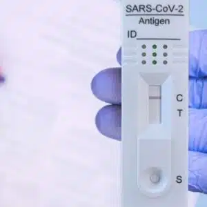 Rapid SARS-COV-2 Antigen Test