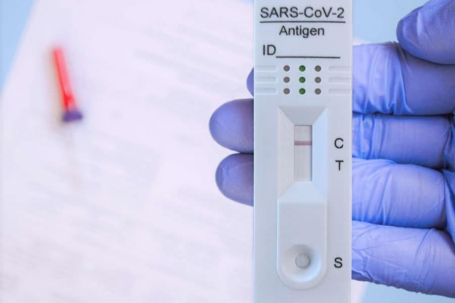 Rapid SARS-COV-2 Antigen Test